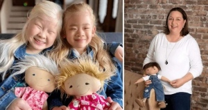 Egy nő segít a fogyatékkal élő gyerekeknek elfogadni magukat, olyan babákat készít, amelyek úgy néznek ki, mint ők